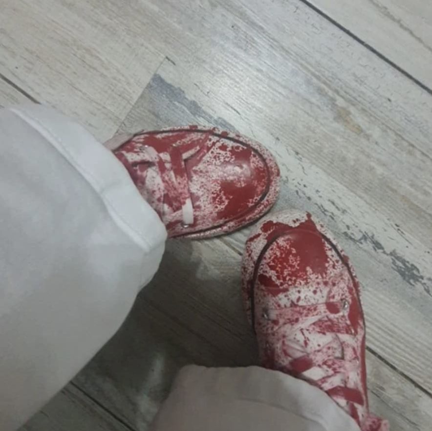 bloody shoes